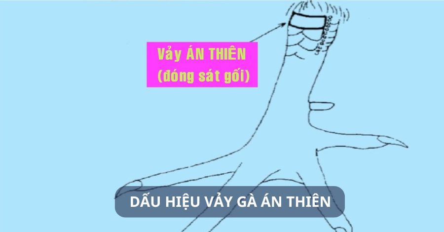 Làm thế nào để nhận biết gà có vảy án thiên?