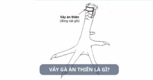 Tìm hiểu vảy gà án thiên là gì?